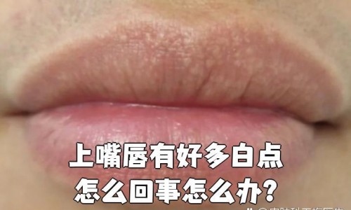 减肥期间早餐搭配网 :分享减肥期间早餐搭配一片面包可以吗-减肥期间早餐搭配一片面包可以吗知识